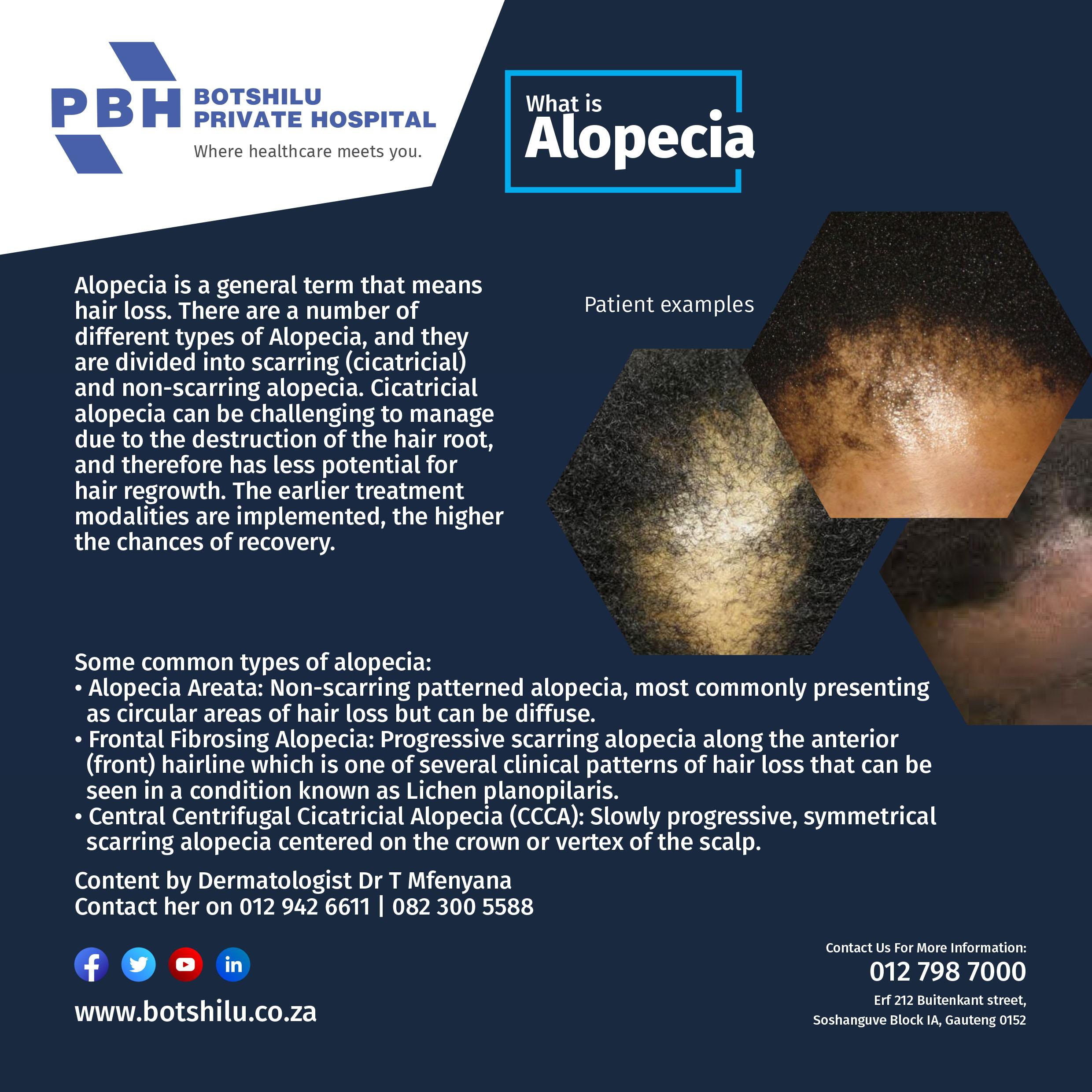 Alopecia (Hair Loss) – Botshilu Private Hospital